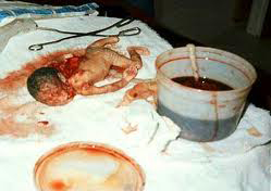 http://www.hinduhumanrights.info/wp-content/uploads/2012/12/abortion2.jpeg