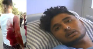 Video : Hindu Victim Says He Was Stabbed By Far Right Islamists For Watching Nupur Sharma Video